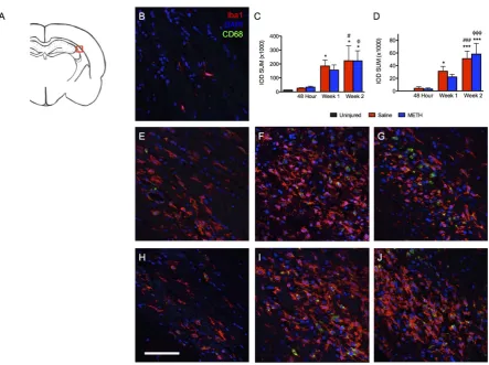 Figure 7. TBI causes a progressive increase Iba1 and CD68 staining within the ipsilateral periventricular white matter