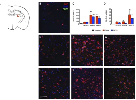 Figure 8. Hemorrhages are observed 48 hours after TBI. Images show the ipsilateral periventricular white matter proximal to the cortical injury 48 hours after TBI labeled with Iba1 (red), CD68 (green) and DAPI (blue)