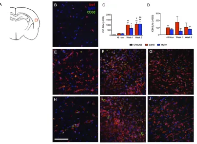 Figure 1. Pattern of Iba1 and CD68 staining in the cortex (injury core) at 48 hrs, 1 week and 2 weeks post-TBI