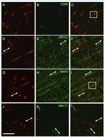 Figure 2. Rod-shaped Iba1+ cells showed variable CD68 staining and aligned with neuronal processes