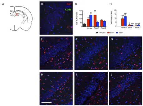 Figure 3. TBI causes increases inIba1 and CD68 staining in the ipsilateral dentate gyrus after injury