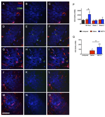 Figure 5. Methamphetamine causes a bilateral increase of Iba1 labeling within the granule cell layer of the dentate gyrus