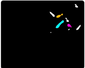 Fig. 4. The second neural network labels the components of the image in Fig. 3(top) passed by the first neural network: mandible (light-blue), chin (purple), nose (yellow) and “other” (white).