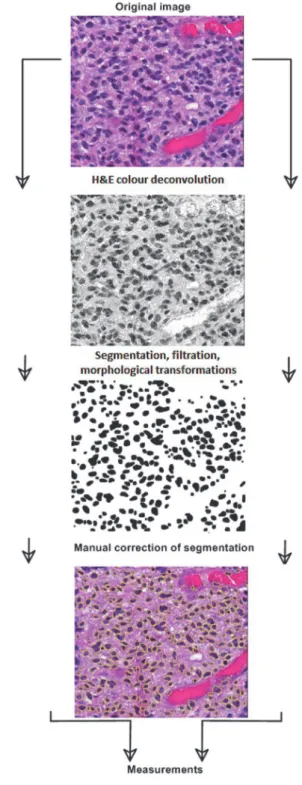 Fig. 1. Stages of segmentation process. 