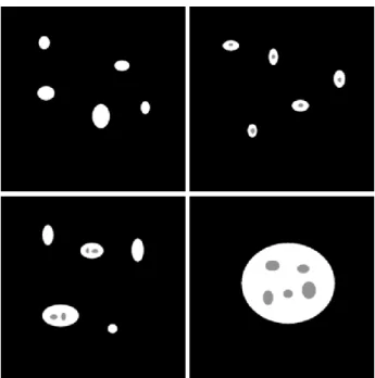 Fig. 1. Schematic illustration of the Euler number for a triphasic structure with the phases: epithelial cells (white), lumen (grey) and stroma (black)