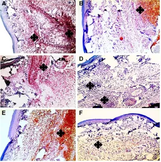 Figure 11 Statistical analysis of inflammatory scores in H&E-stained paw tissues in control and carrageenan-alone groups as well as post-treated group following triple application of the medicated film.Notes: Data are mean ± seM (n=6)