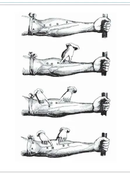 Figure 1. Original illustration of William Harvey’s experiment published in 1628, which demonstrates the blood returning through the veins toward the heart, aided by the presence of valves (Harvey, 1628: p