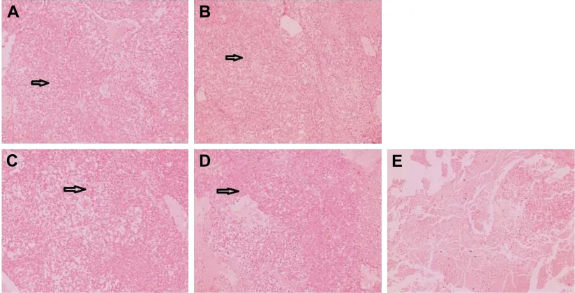 Figure 5 The morphology of rectal tissues after treatment of BUD different formulations.Notes: (A) normal group, (B) BUD suspensions, (C) BUD-es100/Plga nPs, (D) BUD foams, and (E) untreated group