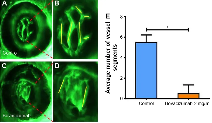 Figure 1 Bevacizumab inhibits zebrafish retinal angiogenesis.Notes: (A–D) Representative fluorescent images of control or embryos treated with bevacizumab at 4 dpf