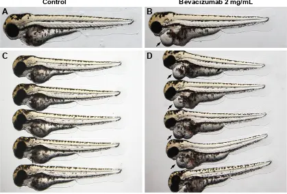 Figure 4 The vascular defect in SIV (subintestinal vein) resulted in further complications such as severe pericardial edema.Notes: (A–D) Representative bright field images of zebrafish embroys at 3 days post-fertilization (dpf) treated with PBS (control) o