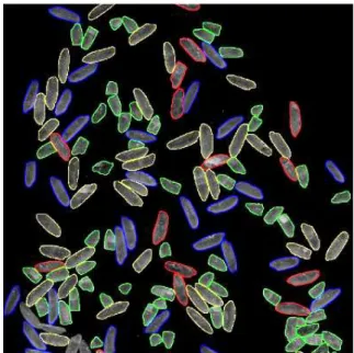 Fig. 15 represents the result of our method on the same image (resulting countours have been projected on the original grey-level image)