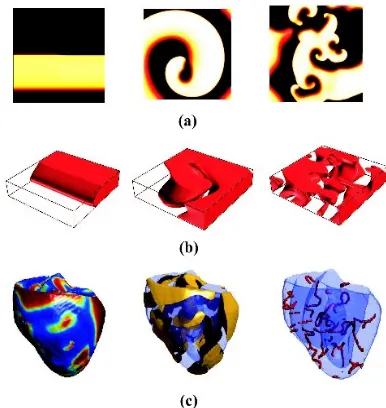 Fig. 1. Examples of normal and re-entrant propagation in virtual cardiac tissues. (a) Propagation of a plane wave (left), single re-entrant wave (middle), and multiple re-entrant waves (right) in 150 x 150mm 2D model