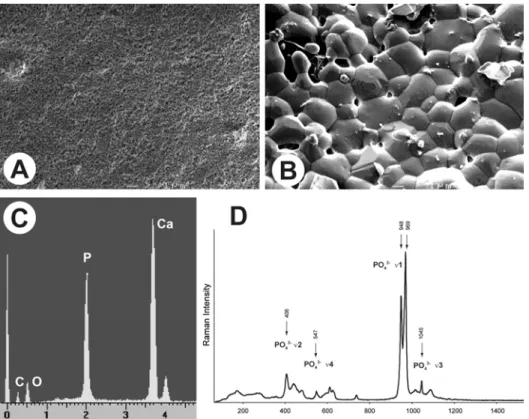 Fig. 2. Scanning electron microscopic analysis of the  β -TCP material prepared by the foam technology at  different steps