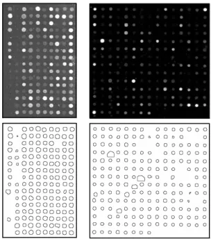 Fig. 8. Two examples of spot segmentation using the present polar GMP algorithm: Top, original microarrays (for visualisation purposes, the intensity has been modified by a gamma function γ = 2)