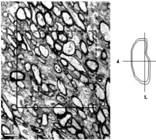 Fig. 5. Left: The rules of the unbiased counting frame:  all nerve fiber profiles completely inside the counting  frame or partly inside it but not touching or intersecting  the full-drawn lines are considered for counting