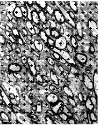 Fig. 6. The number of points hitting white matter,  myelinated nerve fibers and myelin sheaths are  counted separately