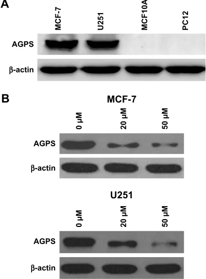 Figure 1 The expression of agPs in Pc12, U251, McF10a and McF-7 cell lines.Notes: (A) The Western blotting assay showed that there was increased expression of agPs in U251 and McF-7 cell lines compared with Pc12 and McF10a cell lines