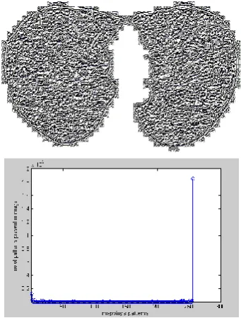 Figure 5. Segmentation of Lung Nodules Using Combined LBPV operator 