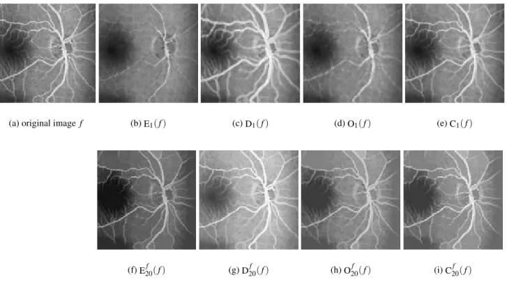 Fig. 6. Usual vs adaptive morphological operators on a blood vessels (a) image f : usual erosion (b) / dilation (c) / opening (d) / closing (e) with a disk of radius 1 as isotropic SE - adaptive erosion (f) / dilation (g) /opening (h) / closing (i) with ad