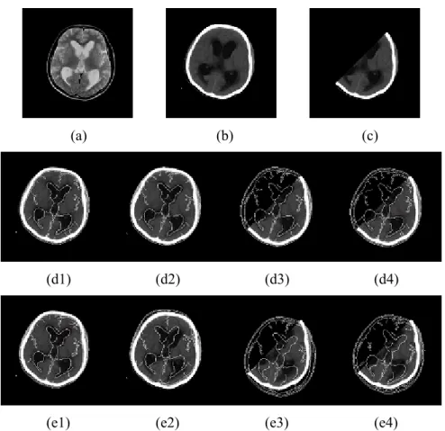 Fig. 4. Illustration of MR-CT registration results based on GCMI and MI. (a) MR floating image