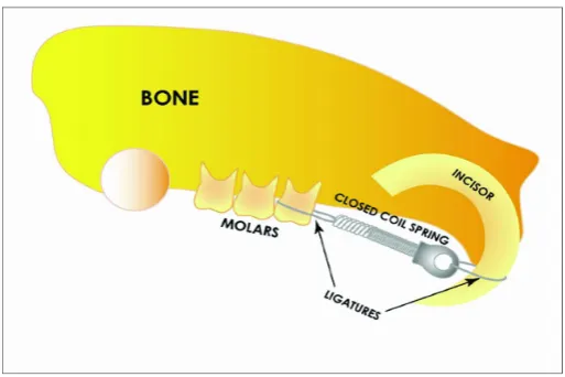 Figure 1. Schematic drawing of the rat model showed the placement of orthodontic appliance