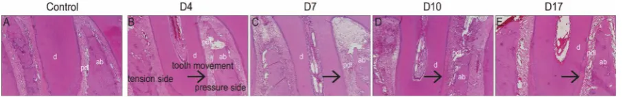 Figure 2. (A) The control group showed no difference in the PDL width between the tension and pressure sides; (B) The experiment group showed the widen PDL width on the tension side compared to the pressure side on day 4 after tooth movement; (C) The PDL w