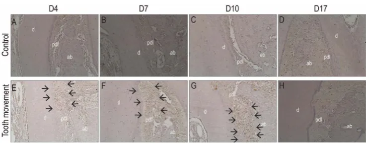 Figure 3. (A)-(D) The control side showed no expression of MMP-9; (E) The minimal expression of MMP-9 was observed on the experimental group at day 4 after tooth movement; (F) The expression of MMP-9 was increased at day 7 after tooth movement; (G) Express
