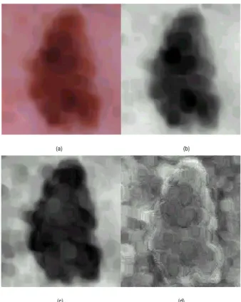 Fig. 5. Results of the Karhunen-Lo`eve transform: (a) the original median filtered color image, (b) the first principal component accounting for 92.29% of the total variance, (c) the second principal component – 7.63%, (d) the third principal lesion – 0.08