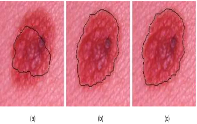 Fig. 11. Original rgb image superimposed with the boundary for various θ values (β = 0.007)