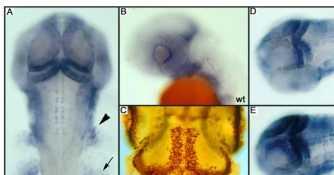 Figure 1. PCNA and Proliferation Patterns(A) PCNA pattern as scored during the screen