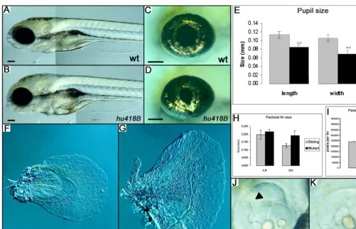 Figure 2. Phenotypes of(C–E) The size of the pupil is reduced in thethe length and width of the pupil is significantly reduced in the(B) Showing an increased volume of the head