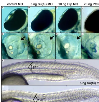 Figure 5. MO Injection Experiments against Su(fu), Hip, and Ptc2(A) Dorsal view of the eye showing the lens in the eye chamber.(B–D) Dorsal view of embryos injected with the indicated MOs, resulting in a phenocopy of dre, uki, and lep mutants.(E) A wild-type ear showing the presence of the dorsolateral septum (arrow), which is not present after injections with the indicated MOs (F–H, arrow).(I) Injections with control MOs against the initiation codon of Su(fu) results in chevron-shaped somites with an angle of 978.(J) Injection of MOs against Su(fu) results in a more obtuse angle of the somite (1268).DOI: 10.1371/journal.pgen.0010019.g005