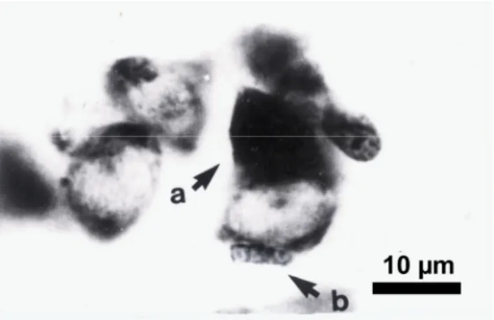 Fig. 2. A typical, well-defined neuron, at a sharp image in the focal plane (a). (b) Probable glial cell(s): the regions between the overlapping and/or the closely adjacent neurons are so dark that it is almost impossible to decide whether it contains a gl