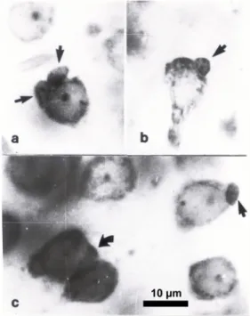 Fig. 10. Well-defined glial cells: Note that their nuclei can be very flat, thin, dark and small in size (straight arrows in a, b and c)