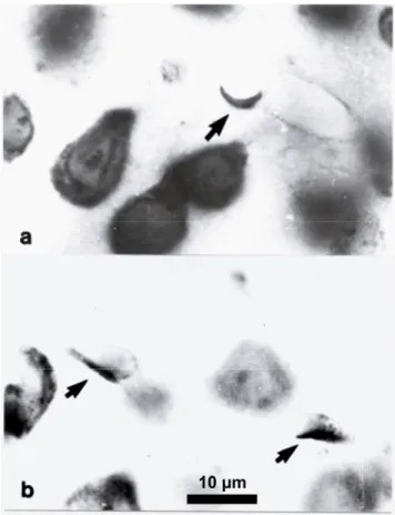 Fig. 12. Uncertain endothelial nuclei: unfolded endothelial nuclei or flat glial nuclei (arrows in a)