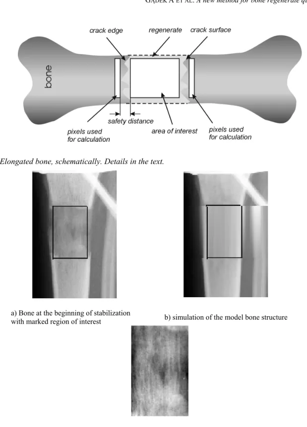 Fig. 7. Elongated bone, schematically. Details in the text.