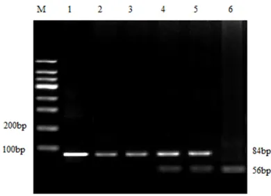 Figure 1. Polymorphism determination of MTHFR C667T gene by PCR-RFLP: Lane 1 and 2 were the CC genotype; lane 3 and 4 were the CT genotype; lane 5 was the TT genotype.
