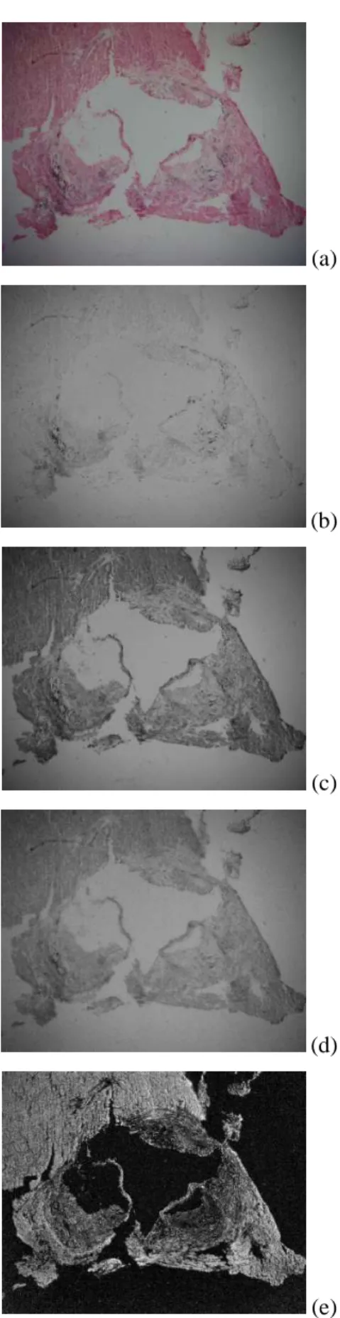 Figure 1. Images under two magnification powers (  2  5 and  10) of a section of the aortic sinus showing the elements of interest: tissue, atherosclerotic lesion and calcification structures.