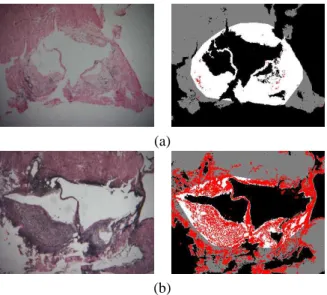 Figure 6. Two examples of aortic section images: (a) with low calcification content (mouse 35); (b) riches in calcification (mouse 40)
