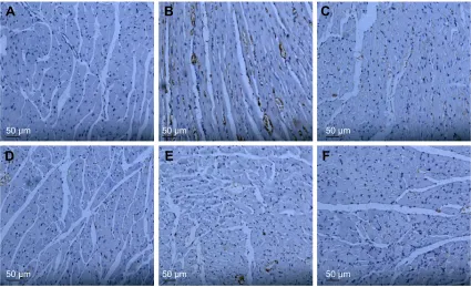 Figure 10 Expression of PF on the expression of Caspase-3 in myocardial cells by immunohistochemistry (inverted microscope, ×200).Note: (A) Sham-operated control, (B) model control, (C) captopril group, (D) low-dose group, (E) middle dose group and (F) high-dose group.Abbreviation: PF, paeoniflorin.