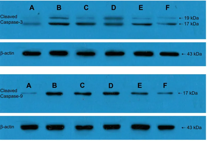 Figure 13 Effects of PF on the expression of Caspase-3 and Caspase-9 in rats with myocardial infarction (x–±s): (A) Caspase-3/β-actin; (B) Caspase-9/β-actin.Note: **P,0.01, n=15/group, versus sham-operated control, ##P,0.01, n=15/group, versus model control.Abbreviation: PF, paeoniflorin.