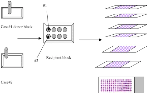 Figure 1Schematic representation of the construction of a TMA blockSchematic representation of the construction of a TMA block
