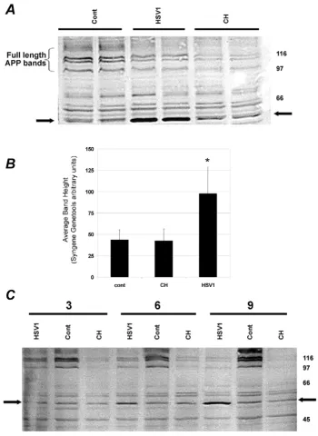 Figure 1Effect of HSV1 infection on APP processing in SHSY5Y cellsAPP antibody (Sigma Aldrich A8717) at 1:4000 dilution