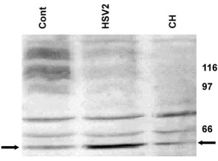 Figure 2Effect of HSV2 infection on APP processing in SHSY5Y cells
