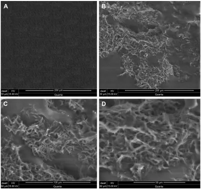 Figure 2 scanning electron microscopy micrographs (A) before drug release at 200 μm, (B) after drug release at 200 μm, (C) after drug release at 100 μm, (D) after drug release at 50 μm.Notes: (A) Shows surface morphology of the polymeric films before the drug release, while (B–D) present surface morphology of polymeric patches after the drug release at different magnification powers.