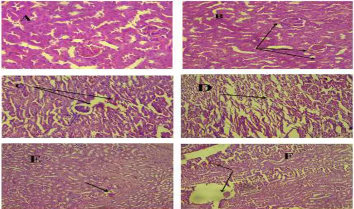 Figure 3: Show histopathol-ogical section of H&amp;E for kidney of male mice treated with bisphenol A  and green tea  extract  for  30  days