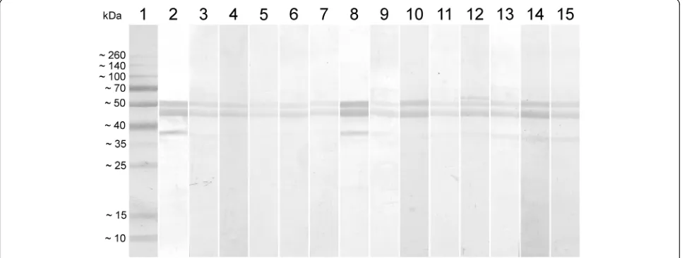 Fig. 3 Evaluation of different batches of rN protein production used as antigen in the indirect ELISA development and tested with positive andnegative sera for IBV