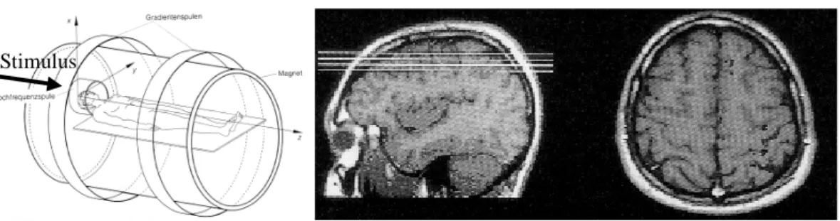 Fig. 1. A sketch of the BOLD-effect related to an  activation is shown in Fig. 2. The distortion of the  signals is the reason that activation patterns are  re-peated to allow a better correlation to the response