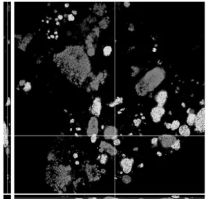 Fig. 1. Sludge flocs: double marked from CLSM. IMAGE PROCESSING METHODS