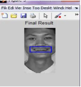 Fig 5: Detected mouth region using Canny_Template method 